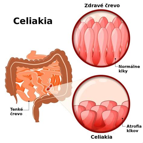 Schematické znázornenie funkčného využívania územia