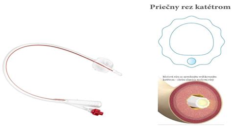 Infografika porovnávajúca rôzne typy materiálov pre vodovodné armatúry