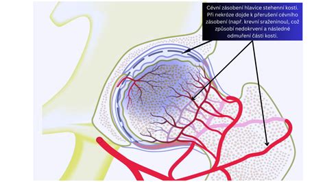 Diagram prietoku krvi do hlavice stehennej kosti