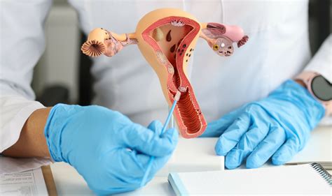 ilustrácia odberu cytologického steru z krčka maternice