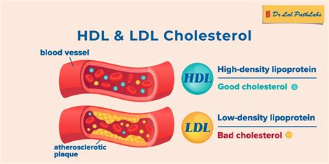 Porovnanie LDL a HDL cholesterolu
