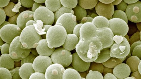 Mikroskopický snímok kvasiniek Saccharomyces cerevisiae