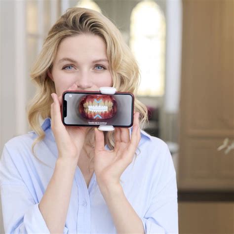 Intraorálne skenovanie zubov