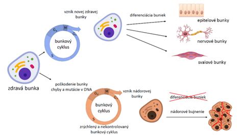 Diagram znázorňujúci interakciu nádorových buniek s osteoklastami a osteoblastmi, vedúcu k deštrukcii kostného tkaniva