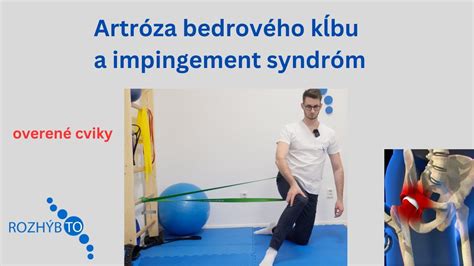 Ilustrácia bedrového kĺbu