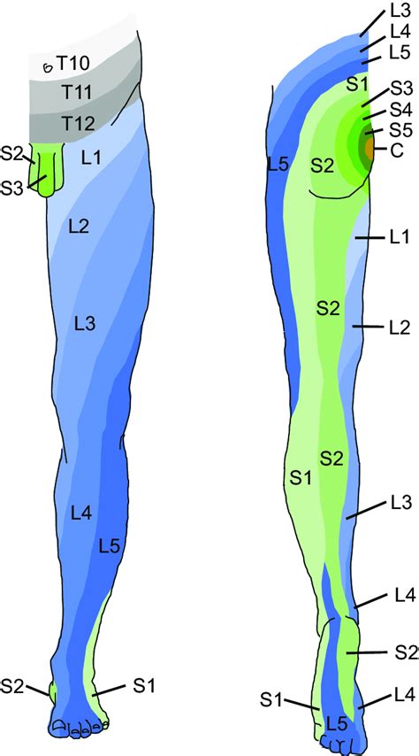 Detailná anatomická kresba driekovej chrbtice s vyznačenými platničkami L4-L5 a L5-S1.