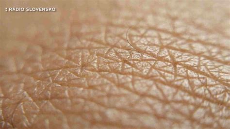 Ilustrácia ľudskej kože s detailom Langerhansových buniek