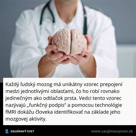 Ilustrácia ľudského mozgu s označenými oblasťami