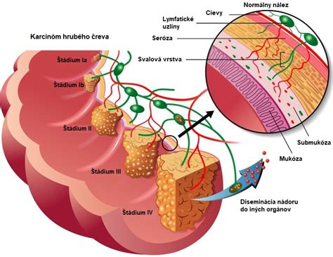 Diagram znázorňujúci funkciu hrubého čreva a vplyv vlákniny a tekutín