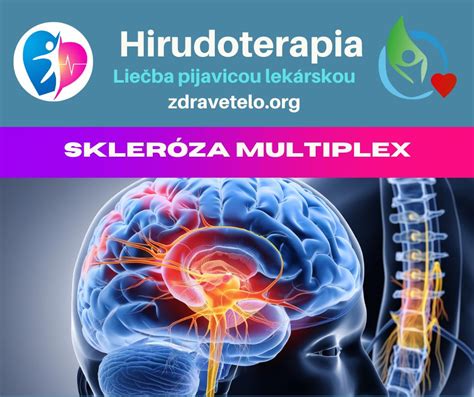 Schematické znázornenie mozgu a nervového systému