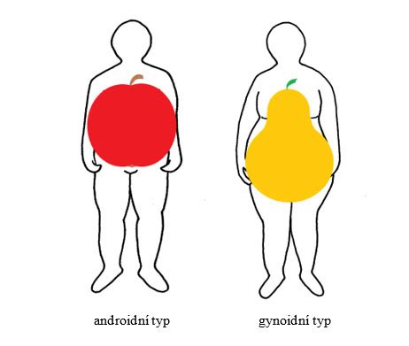 Ilustrácia znázorňujúca androidný a gynoidný typ obezity