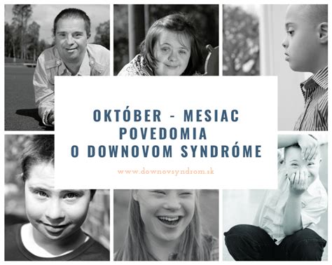 schéma chromozómového zloženia pri Downovom syndróme