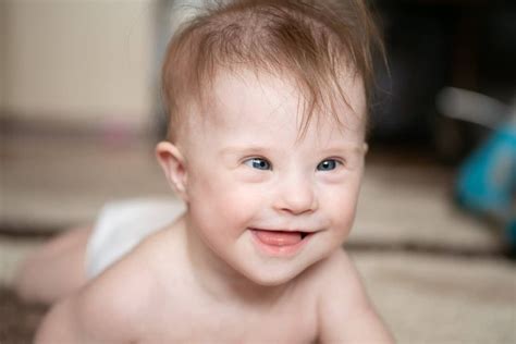 Koláž detských tvárí s Downovým syndrómom zobrazujúca rozmanitosť