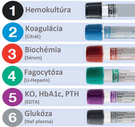 Ilustrácia odberu krvi pre diagnostiku