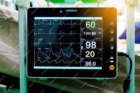medical monitor showing vital signs