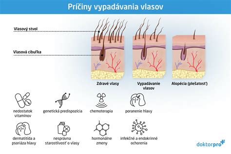 Fázy zosvetľovania vlasov