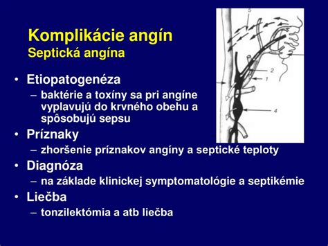 Diagram znázorňujúci možné komplikácie angíny