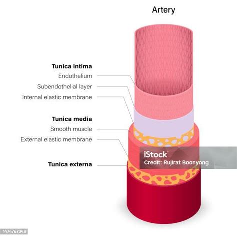 Diagram tepny s aterosklerotickým plátom