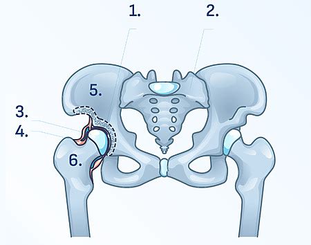 Diagram zobrazujúci kĺb psa a vplyv artritídy