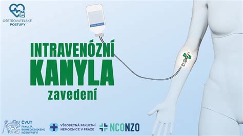 Infografika znázorňujúca možné komplikácie pri zavedení kanyly