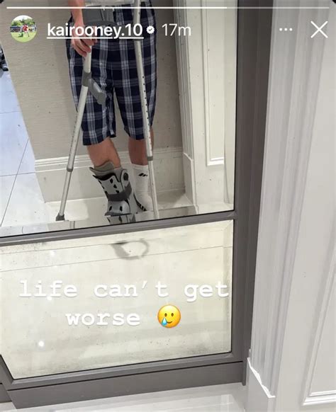 Fotografia Kaia Rooneyho na barlách s obviazanou nohou