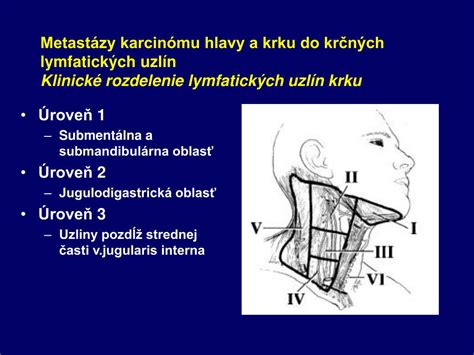 Ilustrácia lymfatických uzlín na krku