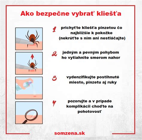 Ilustrácia správneho odstránenia kliešťa pinzetou