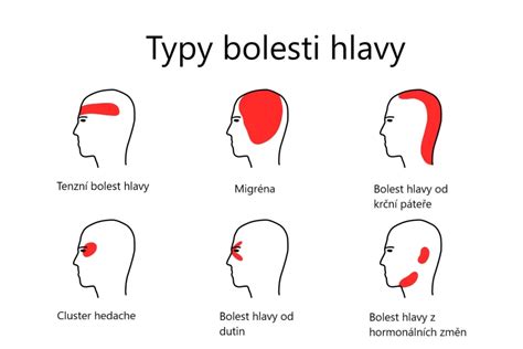 infografika o hydratácii a bolesti hlavy