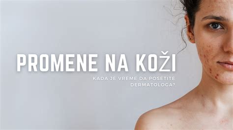 Ilustrácia psoriatických plakov na koži