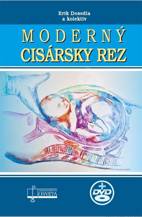 lekársky tím vykonávajúci cisársky rez