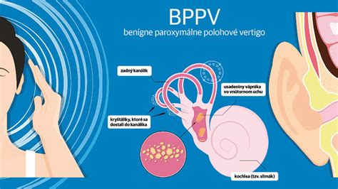 Infografika zobrazujúca vnútorné ucho a jeho funkciu pri rovnováhe