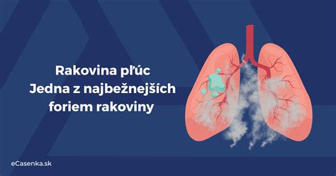 Rizikové faktory rakoviny pľúc