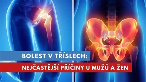 Infografika zobrazujúca rôzne príčiny bolesti stehna