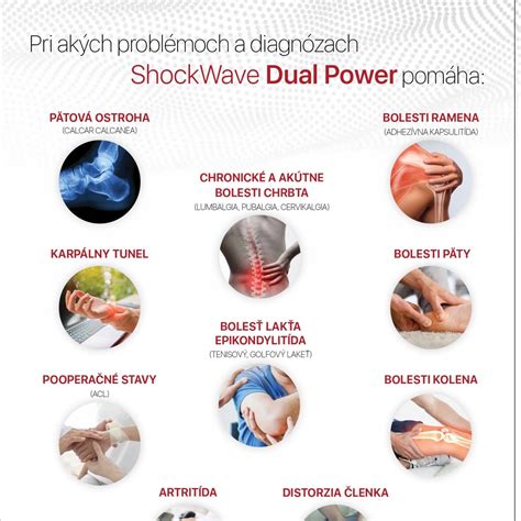 Infografika: Porovnanie výpovedných lehôt pri rôznych typoch nájomných zmlúv