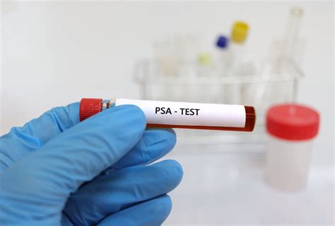 Muž venčiaci psa v parku