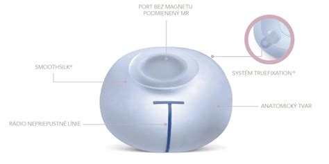 Schéma rekonštrukcie prsníka pomocou expandéra a implantátu