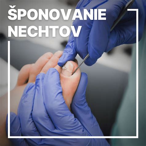 Príprava nechtov pred aplikáciou stavebného gélu