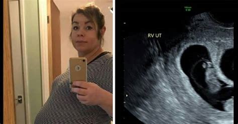 Ultrazvukový snímok embrya