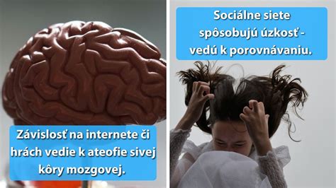 Infografika znázorňujúca vplyv sociálnej izolácie na mozog