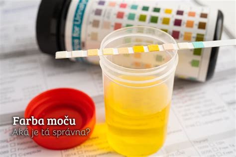 Osoba kontrolujúca farbu moču v priehľadnej nádobe