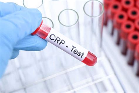 Ilustrácia molekuly CRP