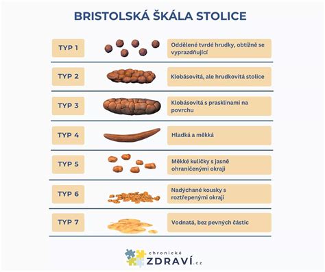 Bristolská stupnica stolice