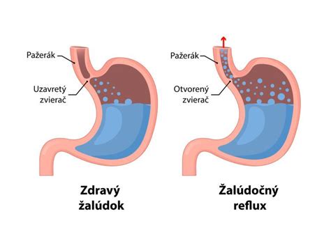 Anatómia pažeráka a žalúdka