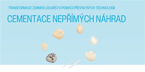 Infografika porovnávajúca rôzne typy zubných náhrad